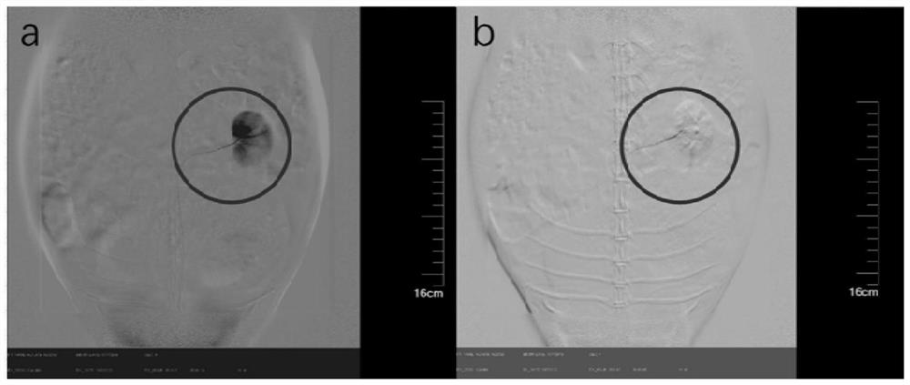 A controllable degradable embolic microsphere responsive to magnetic response hyperthermia and its preparation method and application