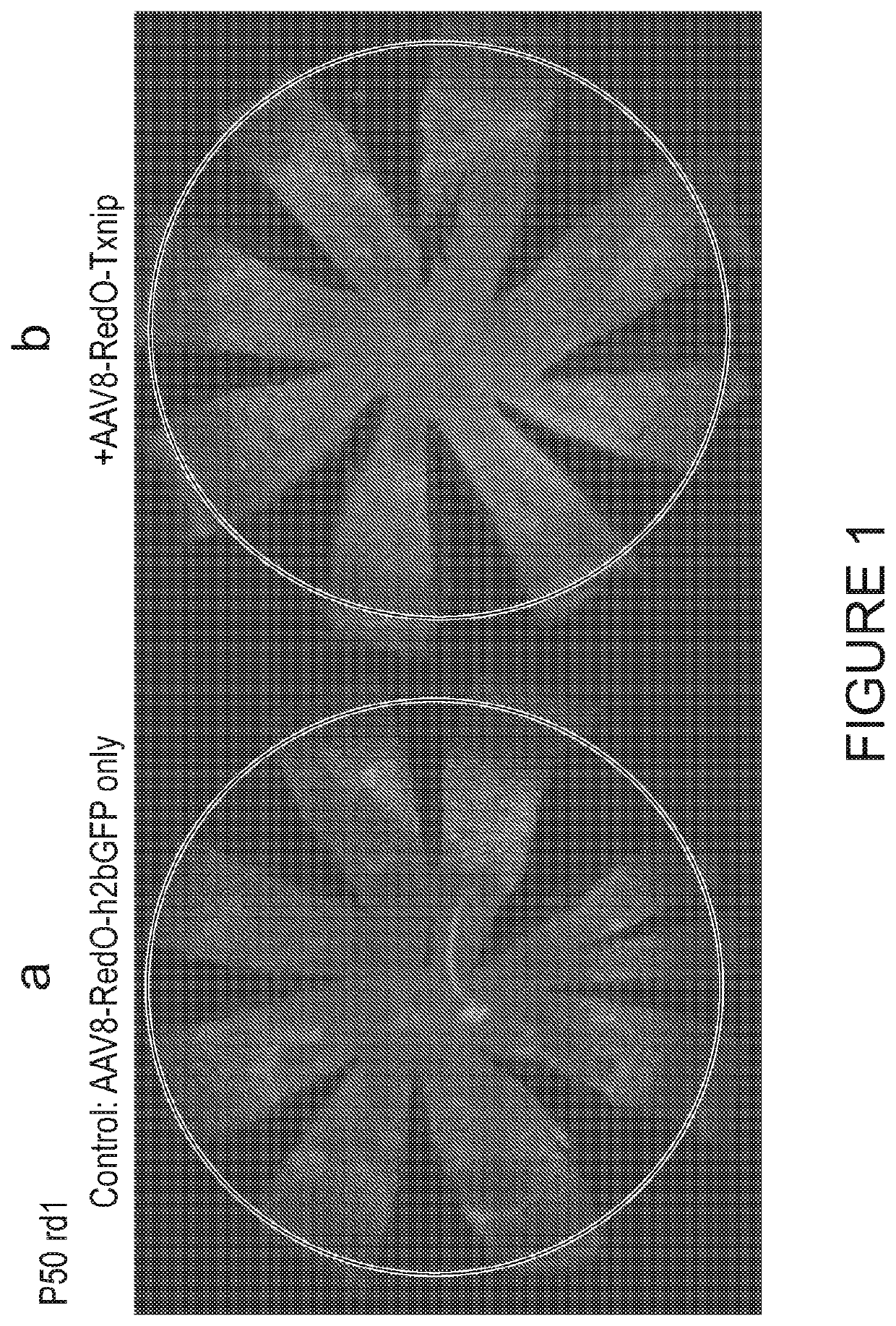 Txnip and ldhb compositions and methods for the treatment of degenerative ocular diseases