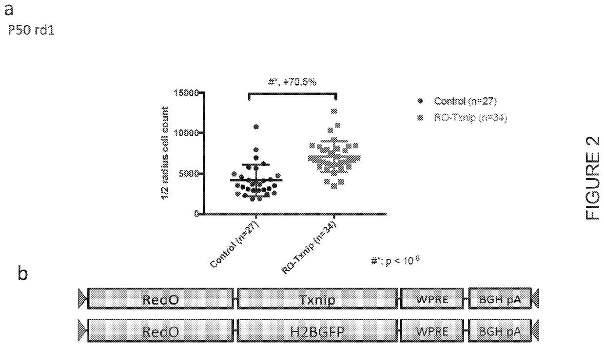 Txnip and ldhb compositions and methods for the treatment of degenerative ocular diseases