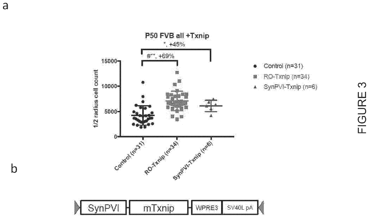 Txnip and ldhb compositions and methods for the treatment of degenerative ocular diseases