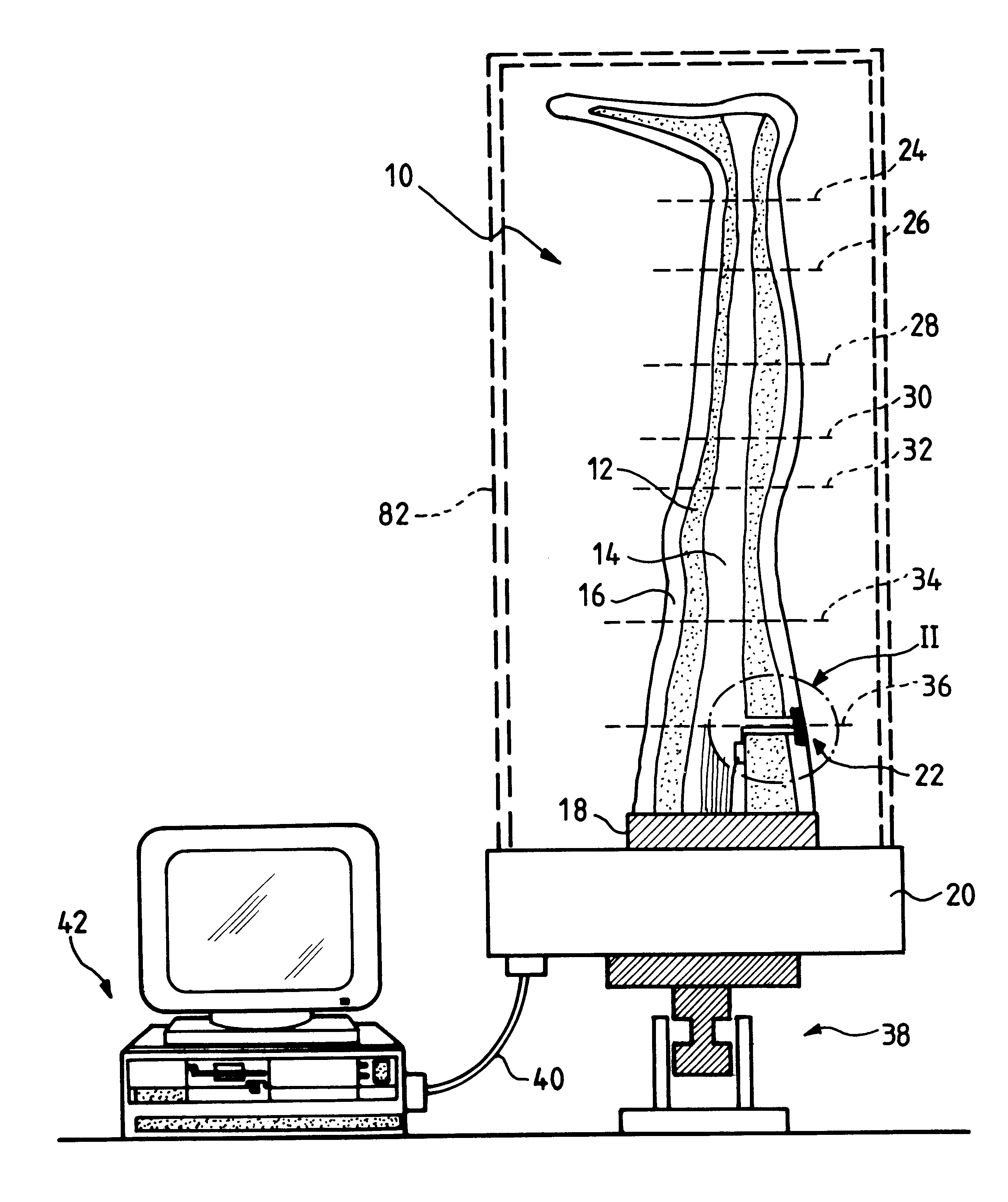 Device for measuring pressure points to be applied by a compressive orthotic device