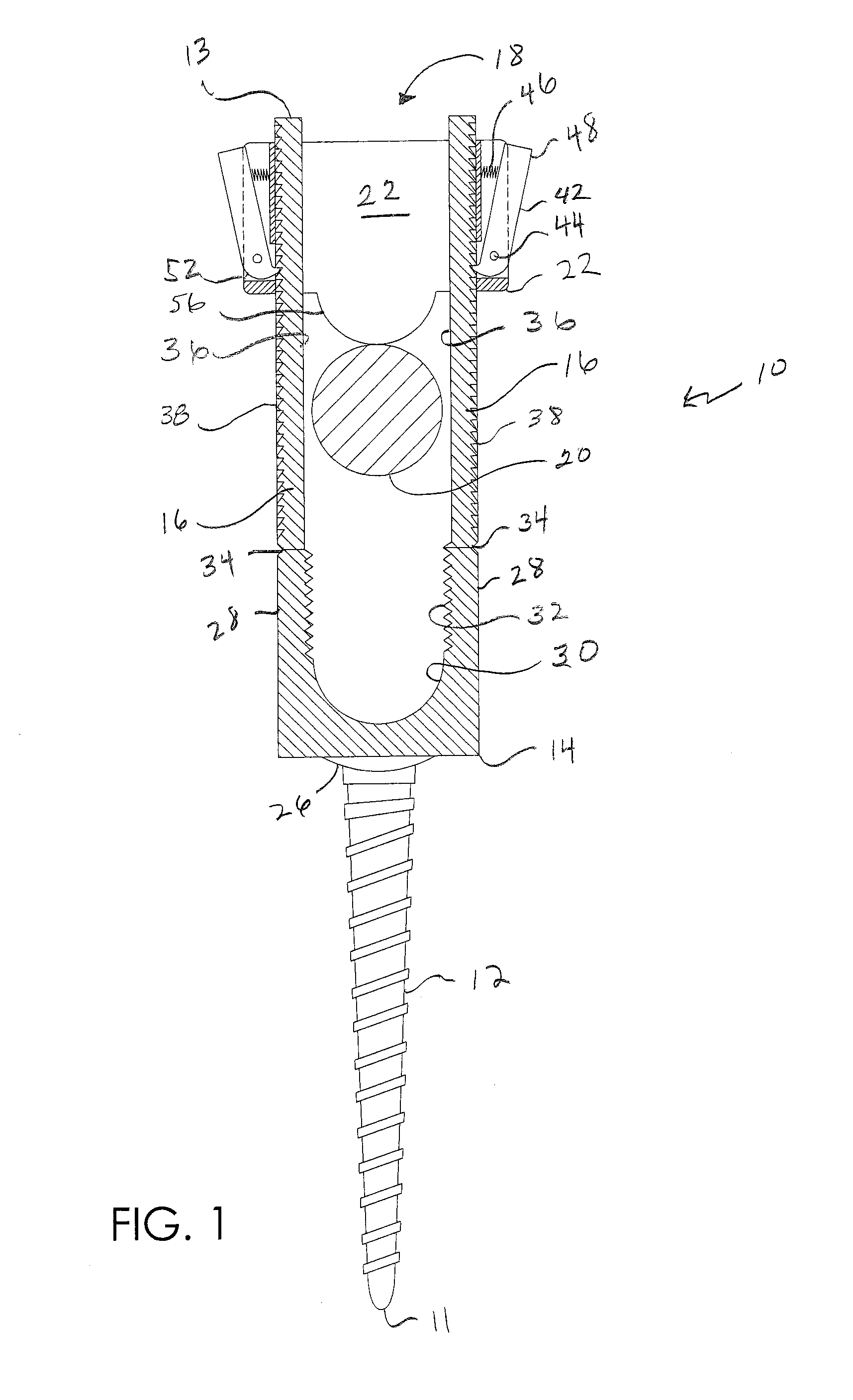 Screw and rod fixation system