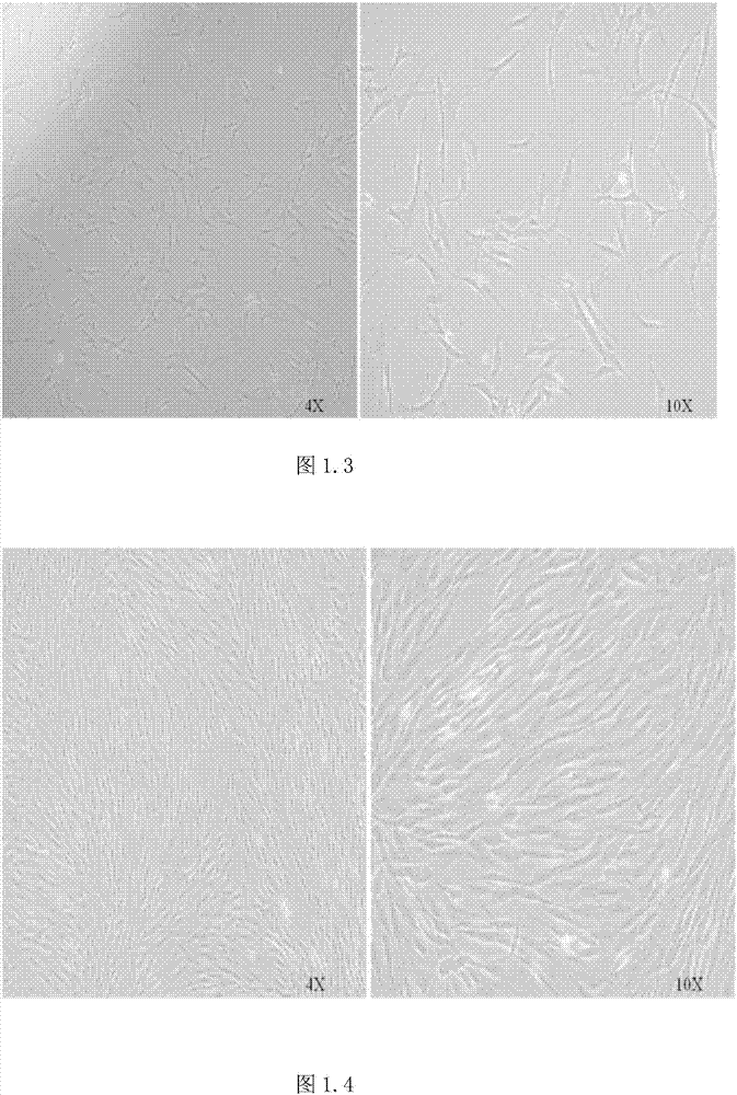 Serum-free culture medium for in-vitro culture and proliferation of mesenchymal stem cell
