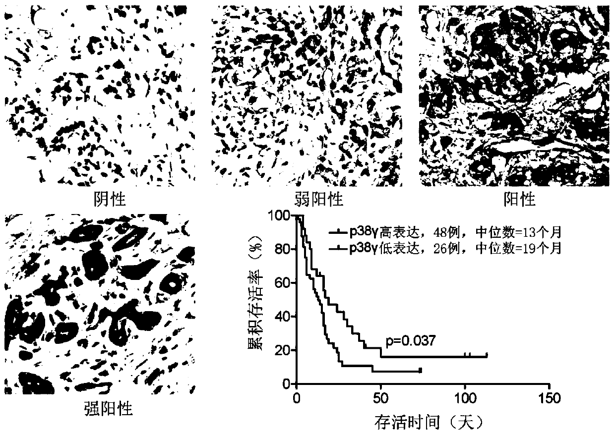 Application of p38 gamma in preparation of pancreatic cancer prognosis diagnostic reagent