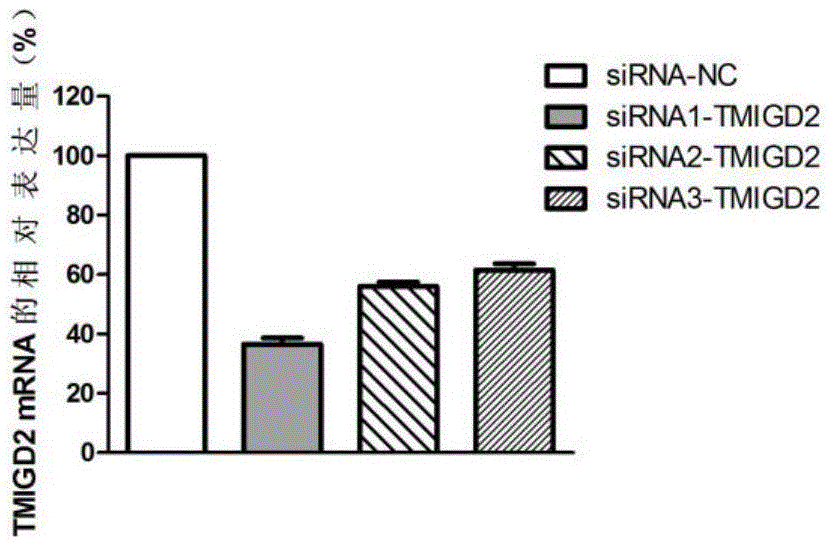 Application of TMIGD2 gene in diagnosing and treating rectal adenocarcinoma