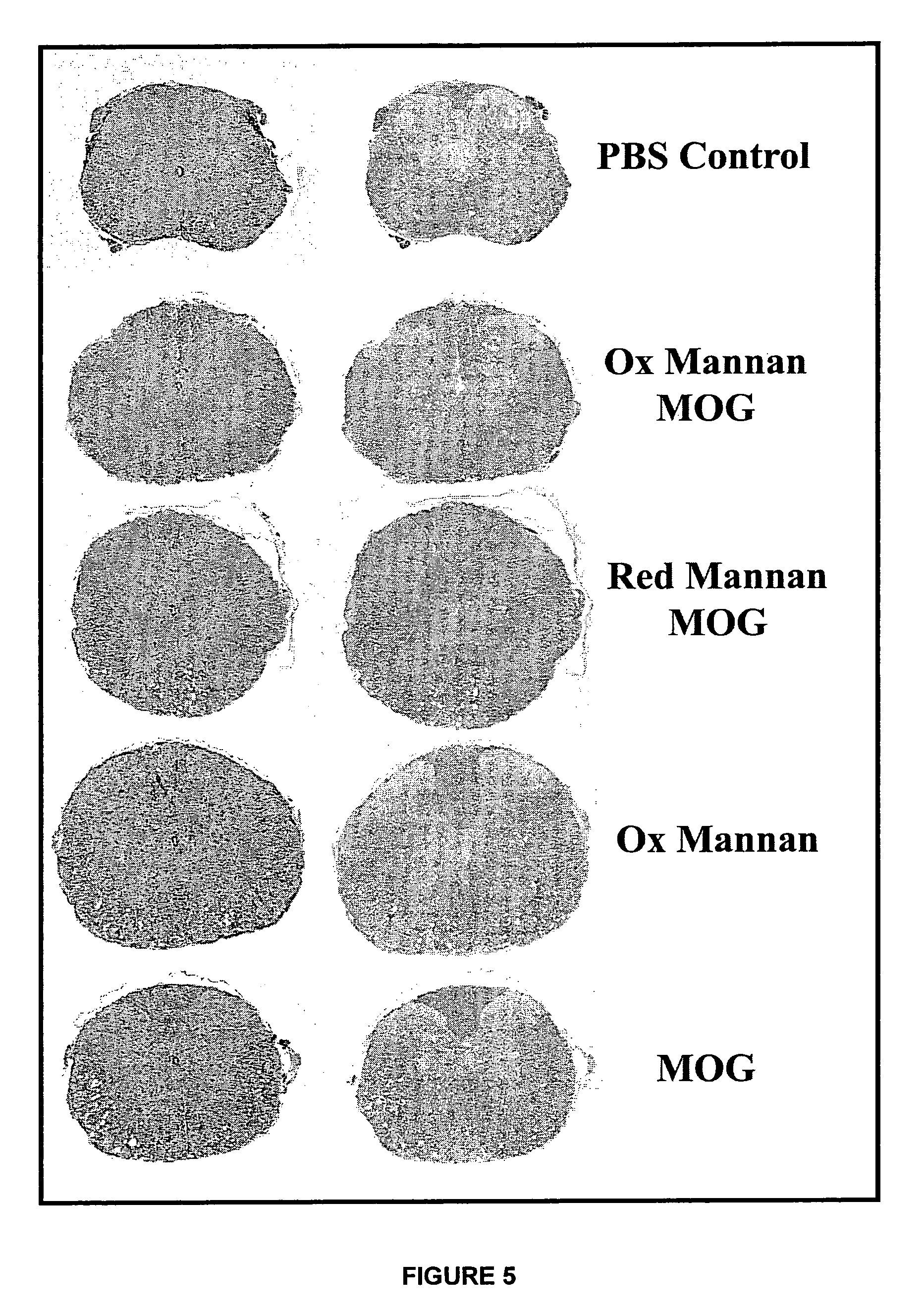 Conjugates comprising mannan and myelin oligodentrocyte glycoprotein (MOG)