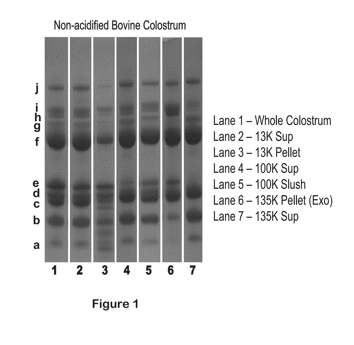 Isolation of exosomes from colostrum powder and exosomal drug formulations using the same