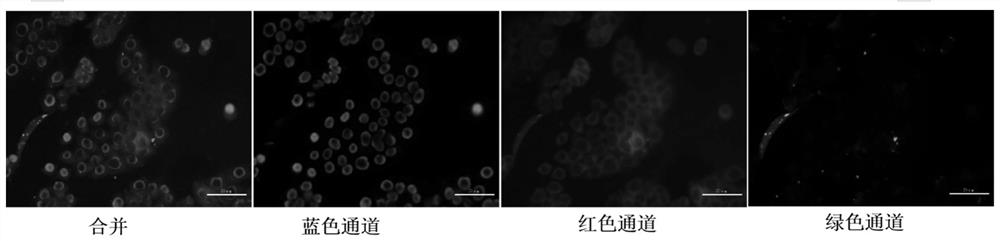 Preparation method of chitosan derivative nanoparticles for delivering siRNA