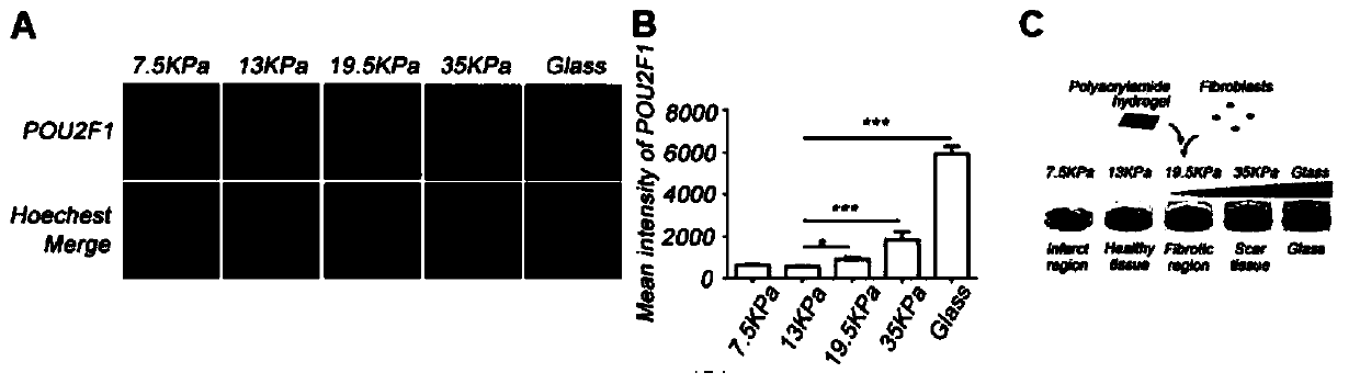 Application of POU2F1 gene expression inhibitor in preparation of drugs treating tissue fibrosis diseases