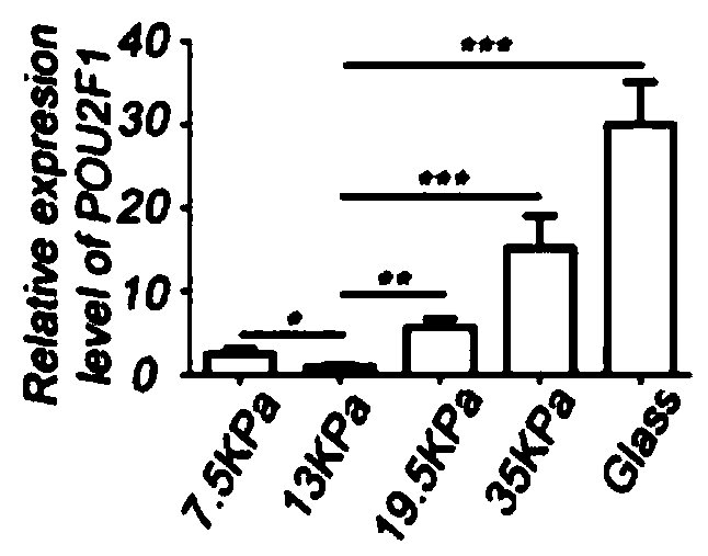 Application of POU2F1 gene expression inhibitor in preparation of drugs treating tissue fibrosis diseases