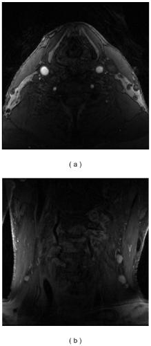 A Multimodal Carotid MRI Registration Method Based on Physical Alignment and Contour Matching