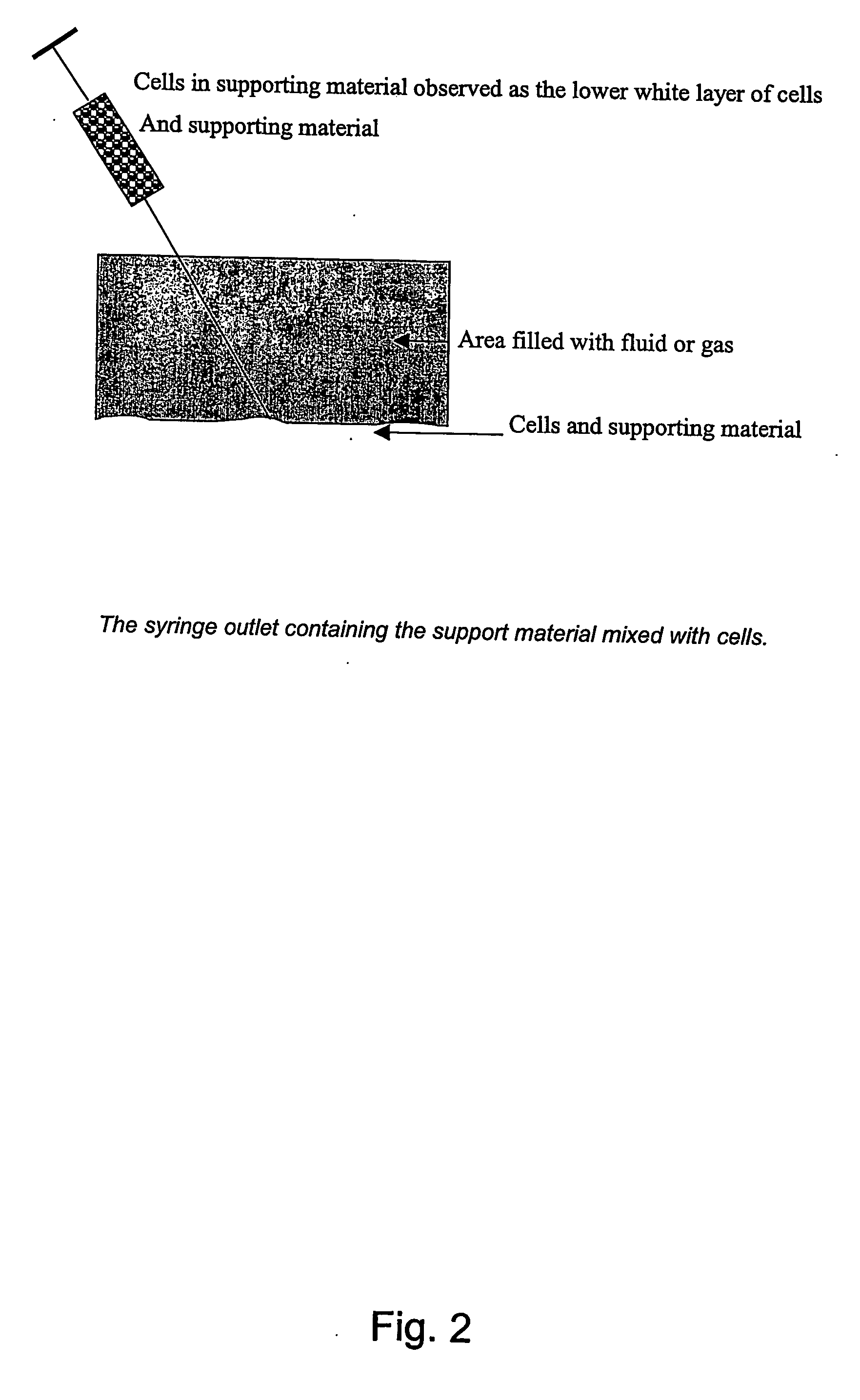 Method for cell implantation