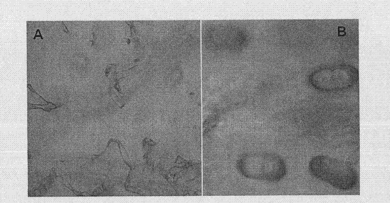 Observation and density measurement method for glandular hairs on Artemisia annua leaf surfaces