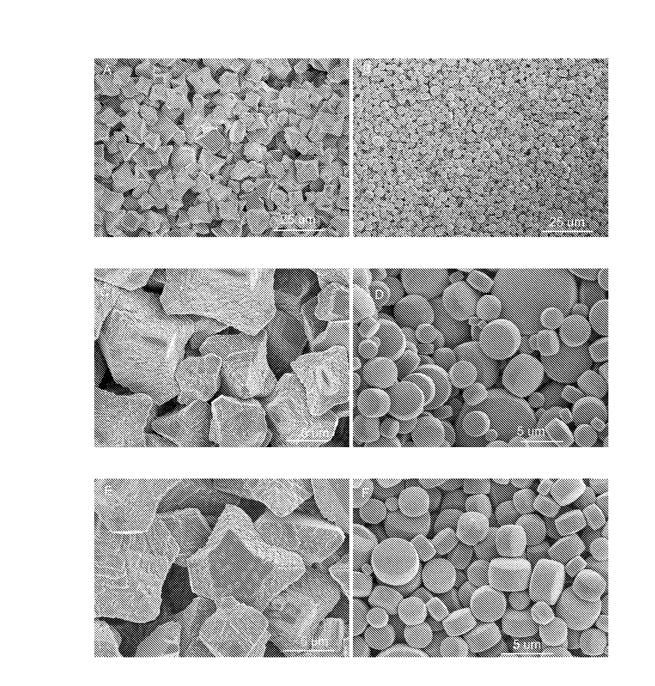Calcium carbonate microtablets and method for the preparation thereof