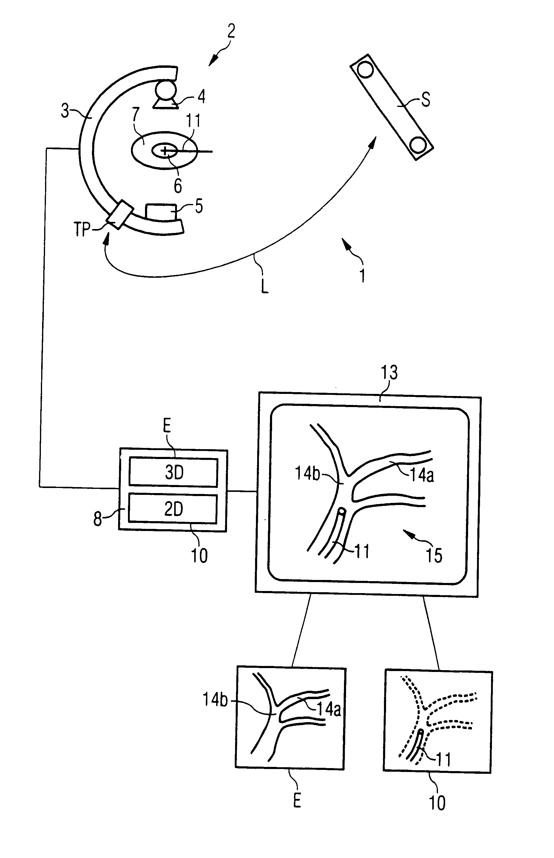 Method for automatically merging a 2D fluoroscopic C-arm image with a preoperative 3D image with one-time use of navigation markers
