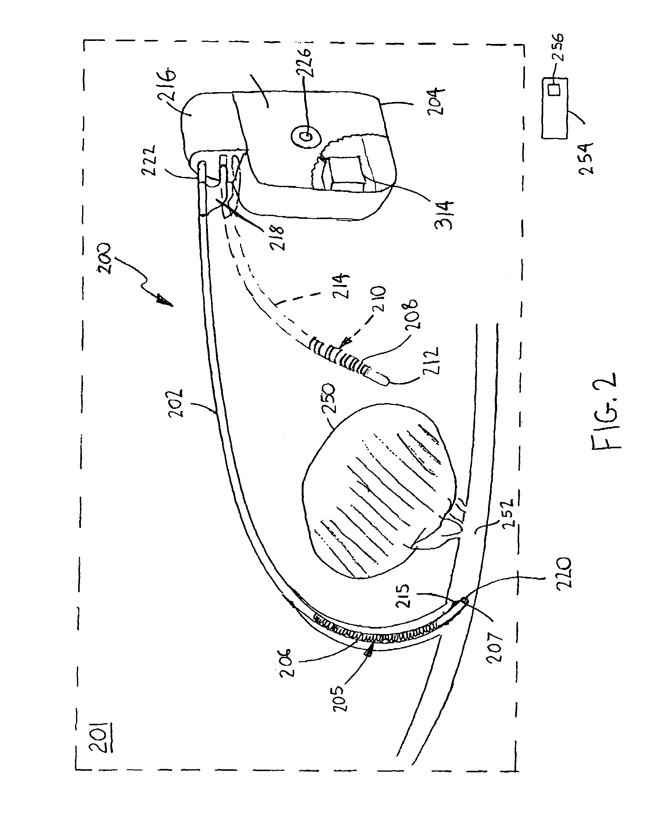 Implantable electroporation therapy device and method for using same