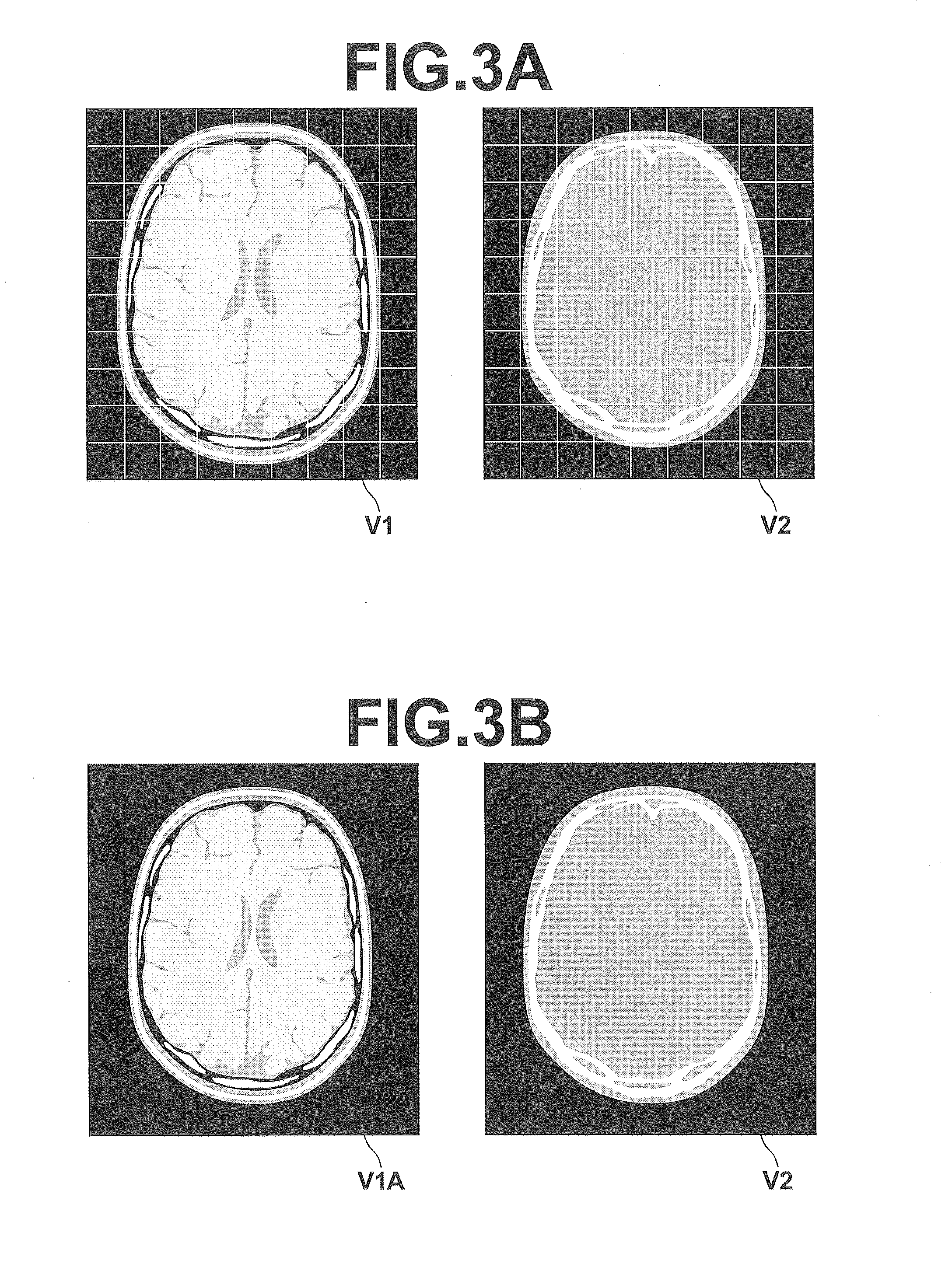 Image processing device, image processing method and image processing program