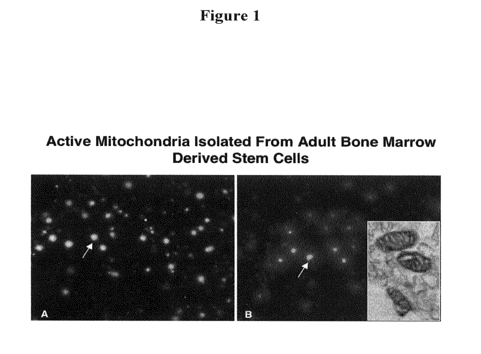 Methods and compositions for mitochondrial replacement therapy
