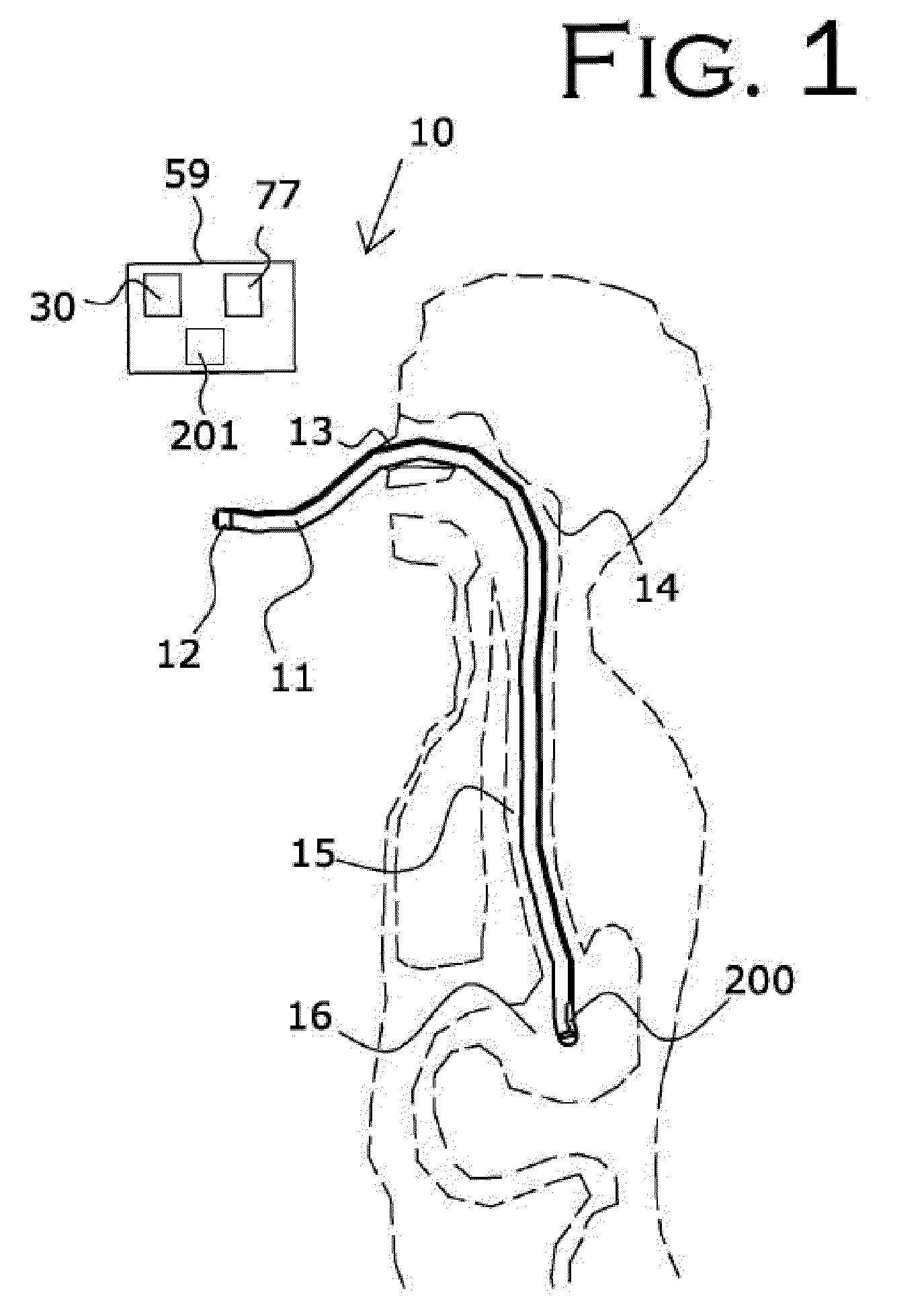 Medical Device Placement and Monitoring System Utilizing Radio Frequency Identification