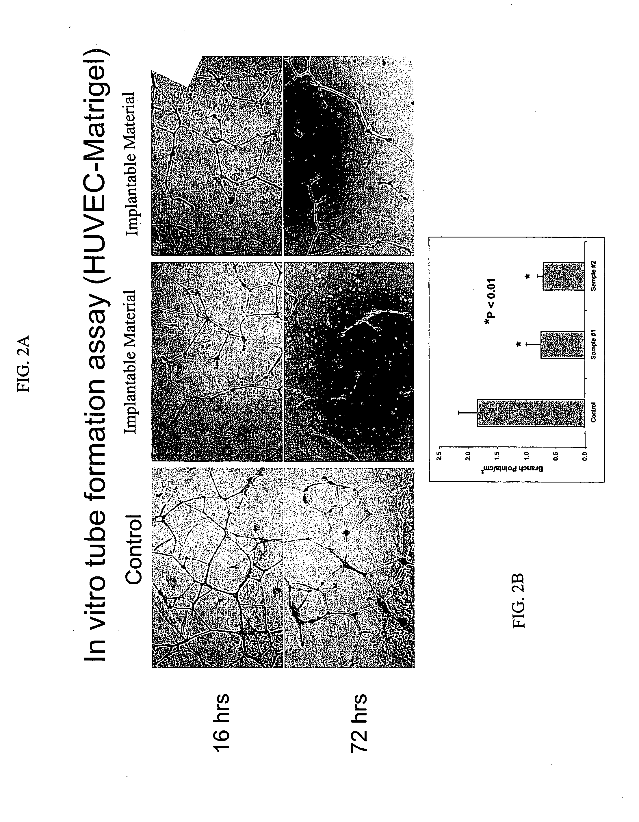 Materials and Methods for Treating and Managing Angiogenesis-Mediated Diseases