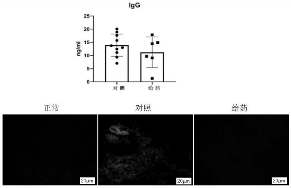 Application of SB431542 in treating and inhibiting lupus nephritis