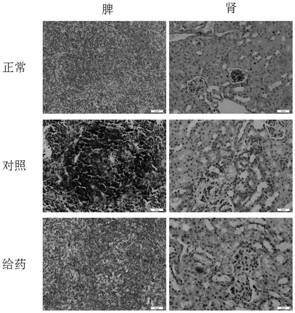 Application of SB431542 in treating and inhibiting lupus nephritis