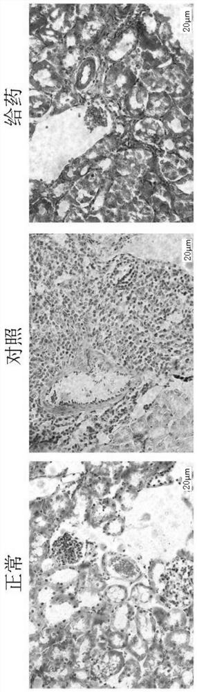 Application of SB431542 in treating and inhibiting lupus nephritis