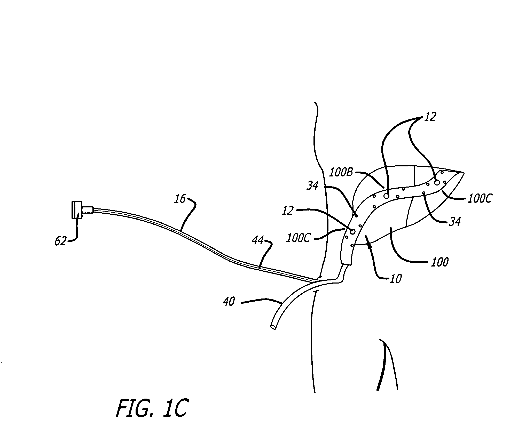 Surgical drain with positioning and protective features