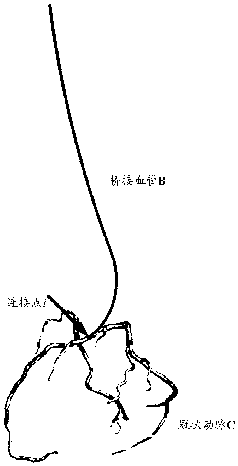 Blood flow determining method, device, electronic device and computer storage medium