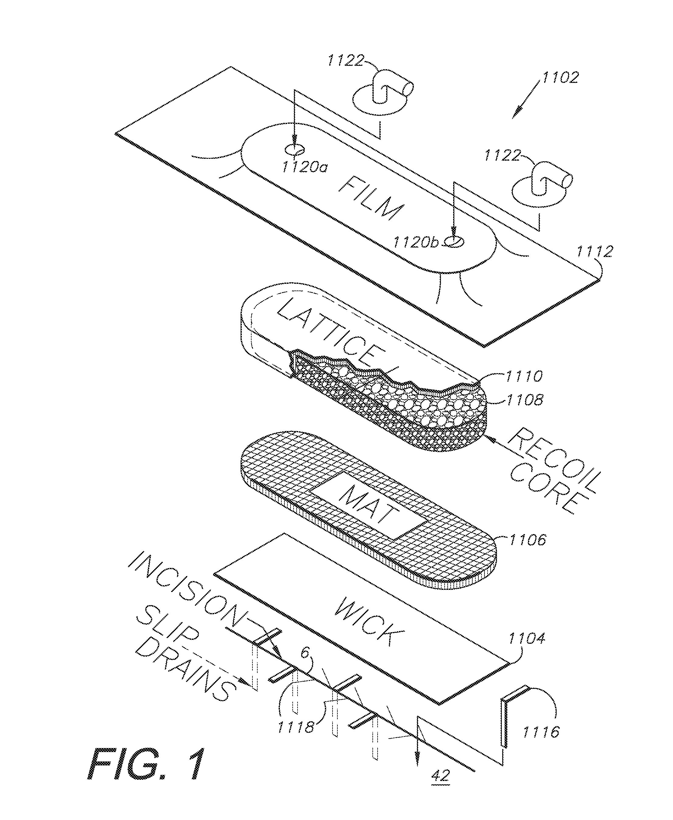 Externally-applied patient interface system and method