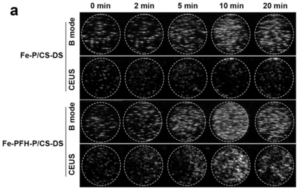Phase-change multi-modal nano contrast agent for targeted therapy of vulnerable plaques