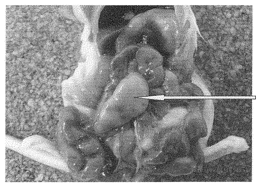 Prophylactic agent for spontaneous cancers