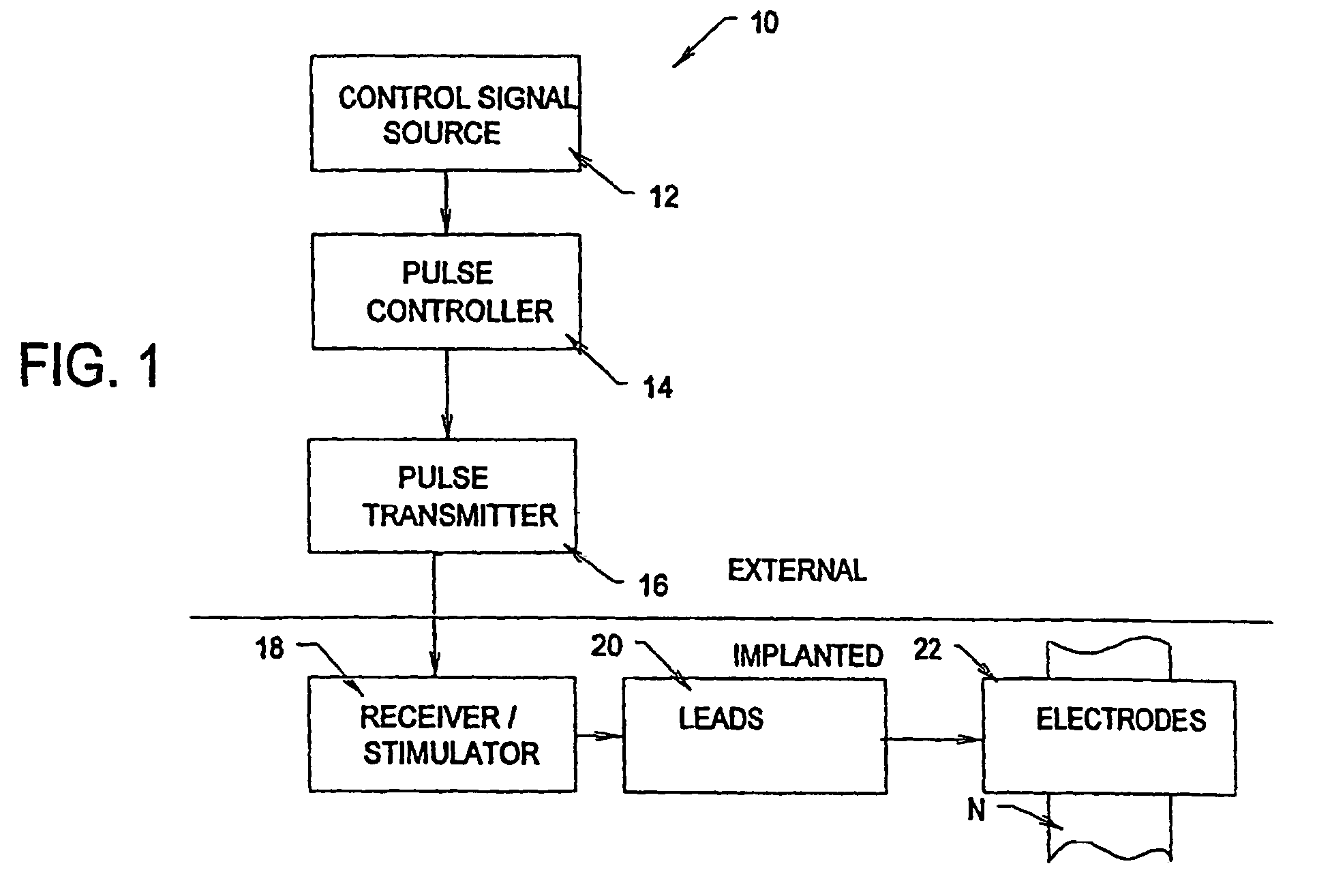 Systems and methods for reversibly blocking nerve activity