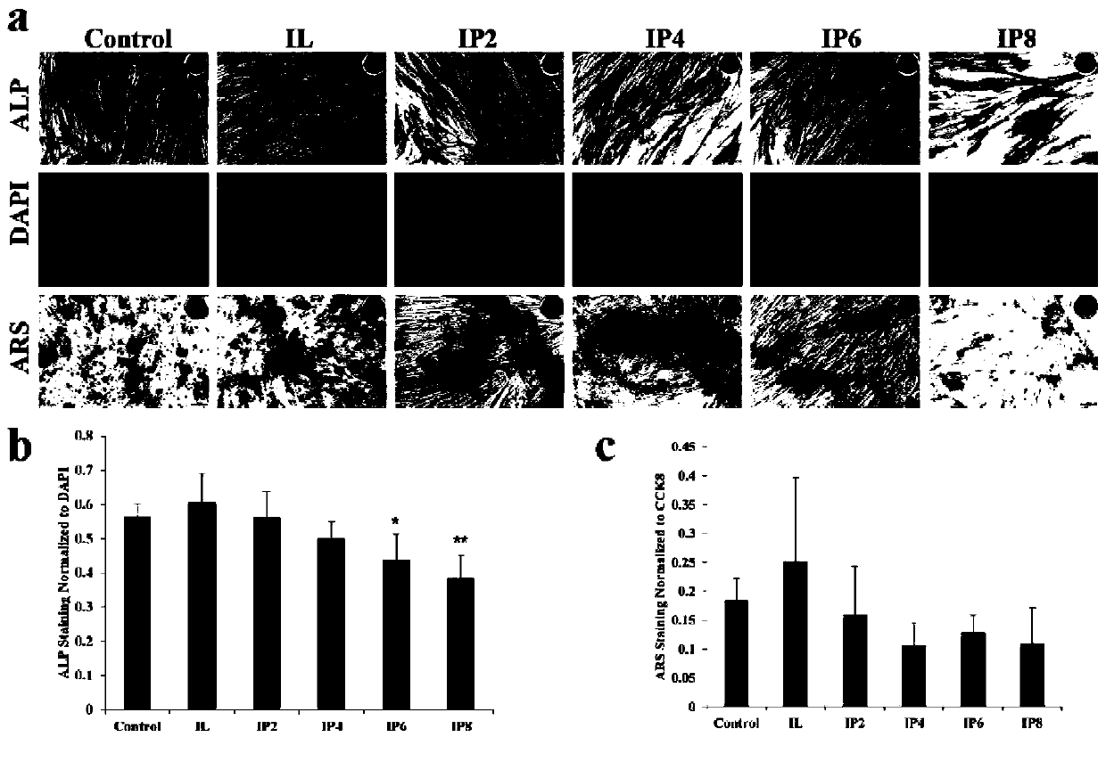 Application of procyanidin SA hydrogel in preparation of medicine for treating tendon ectopic calcification