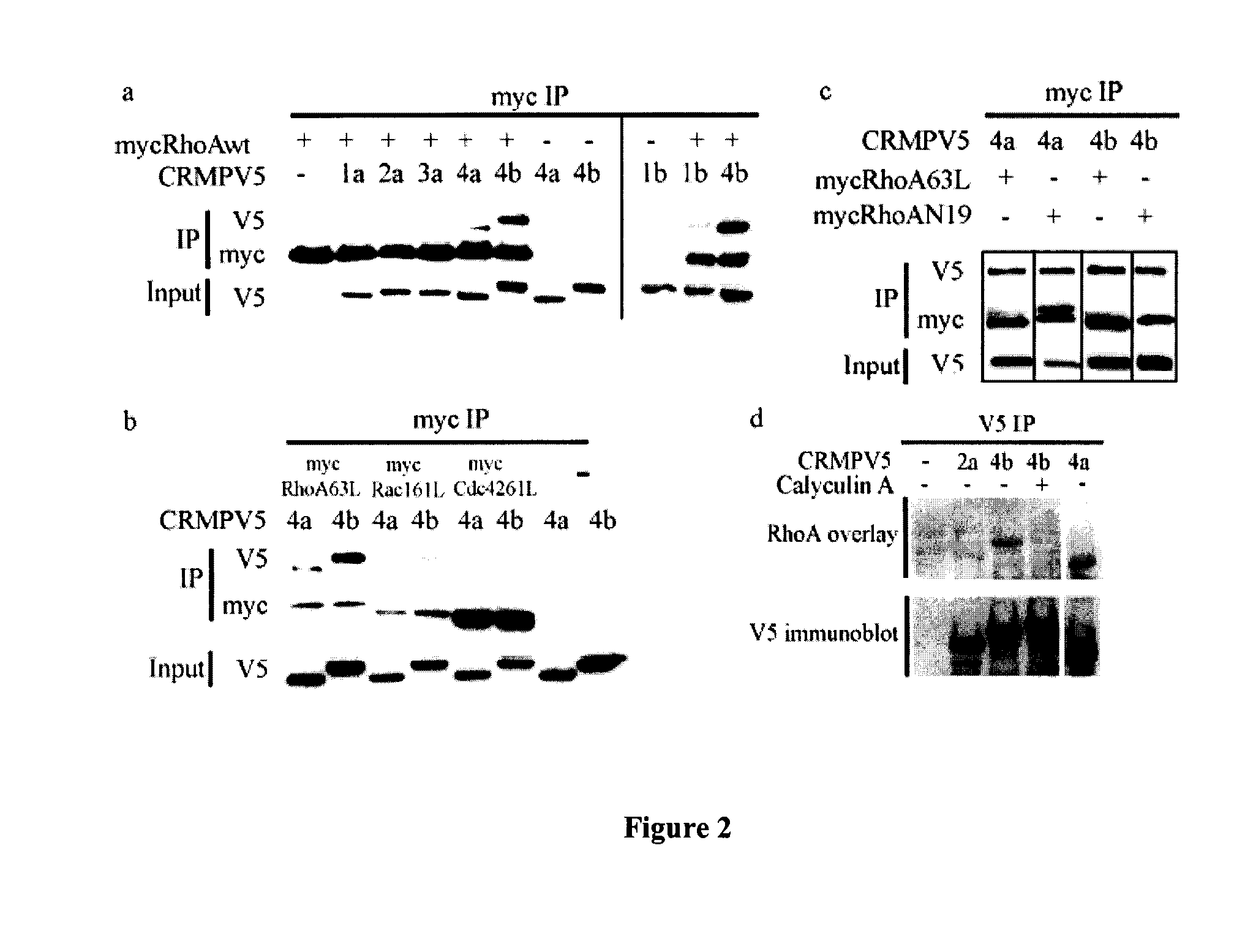CRMP4b inhibitory peptide