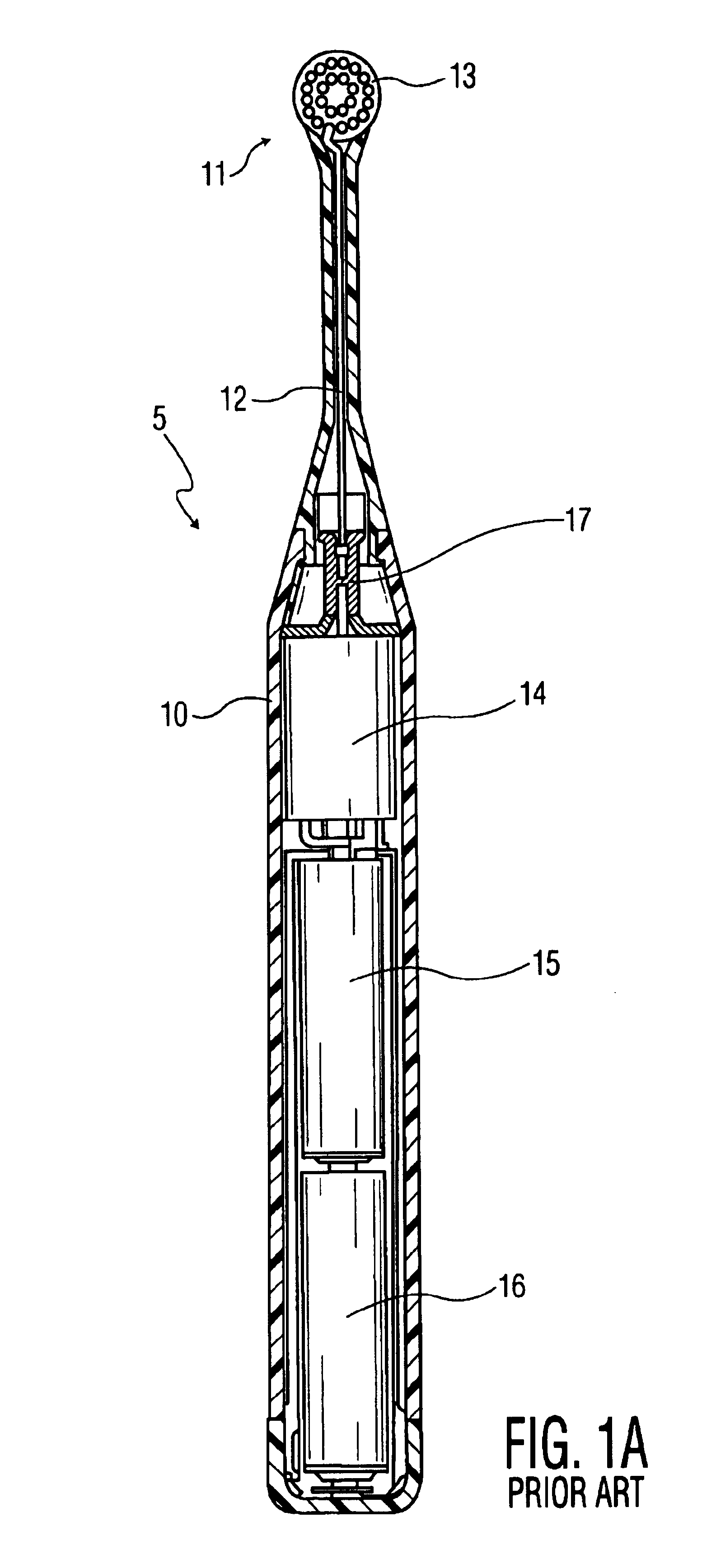 Toothbrush having a movable upstanding cleaning element