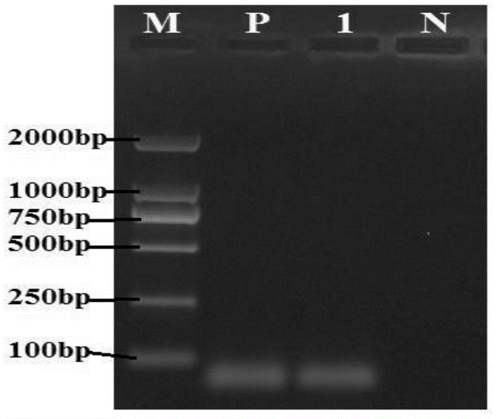 Fluorescence RT-PCR primer, probe and kit for detecting Schmallenberg viruses