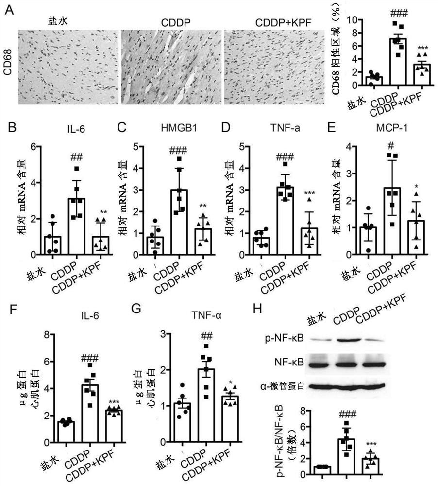 Application of kaempferol in preparation of medicine for treating or improving cardiac injury