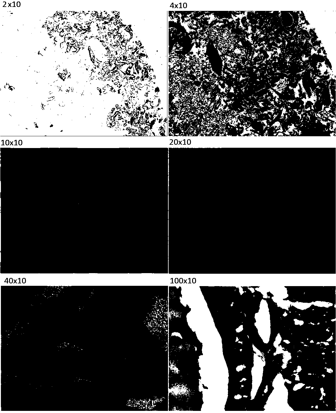 Preparation method for thyroid and mammary fine needle aspiration cell tissue blocks