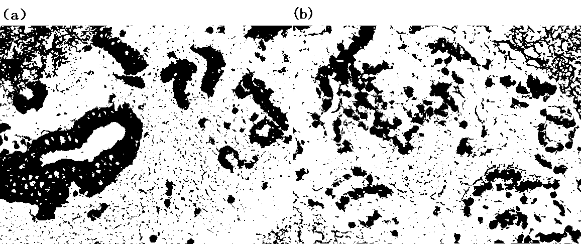 Preparation method for thyroid and mammary fine needle aspiration cell tissue blocks