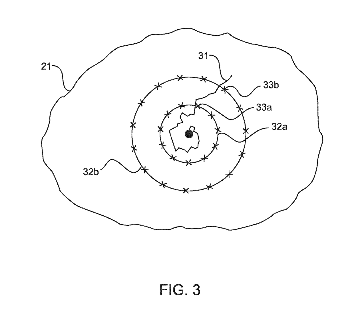 Radiation therapy system using plural treatment plans