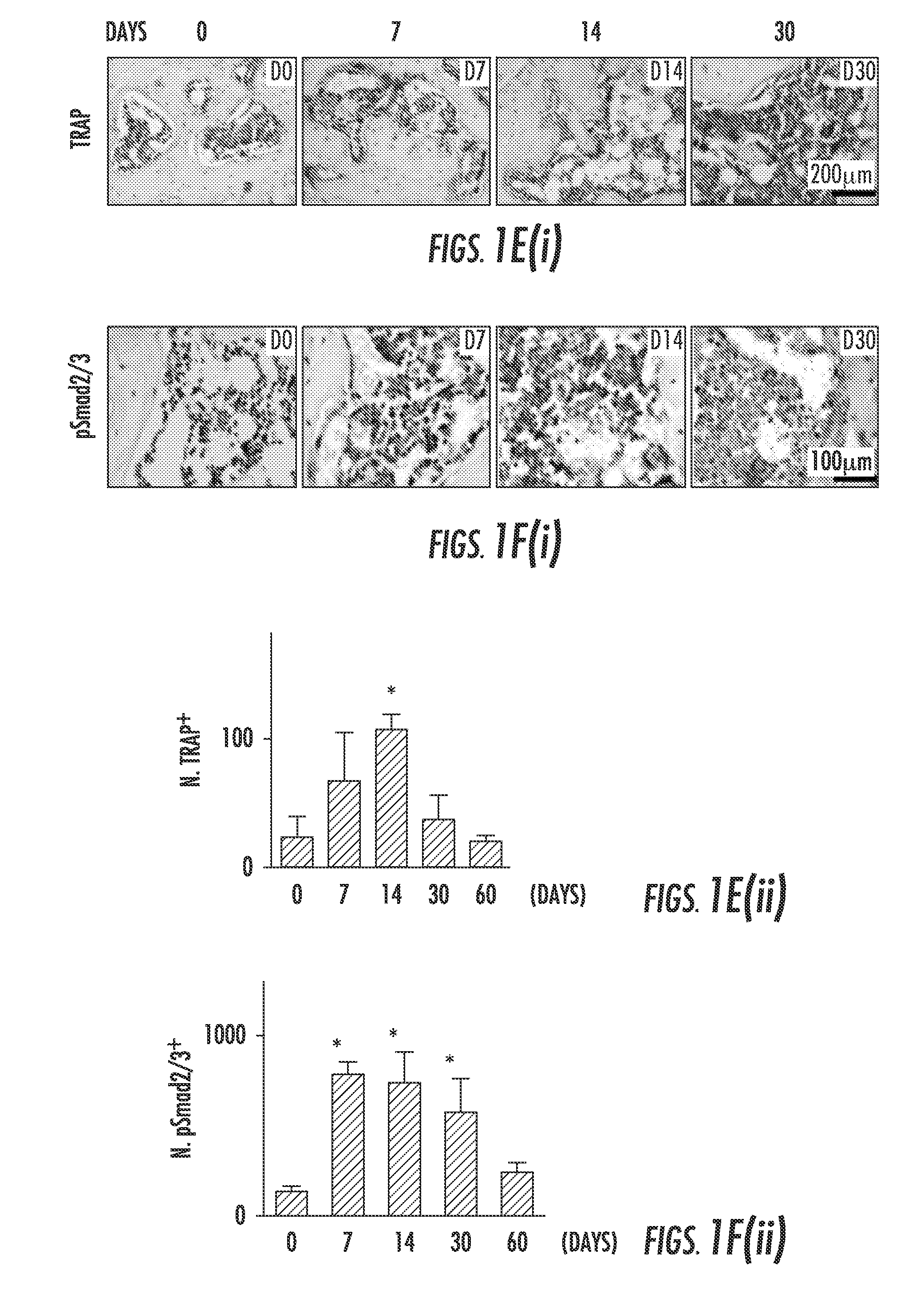 Compositions and methods for treating or preventing osteoarthritis