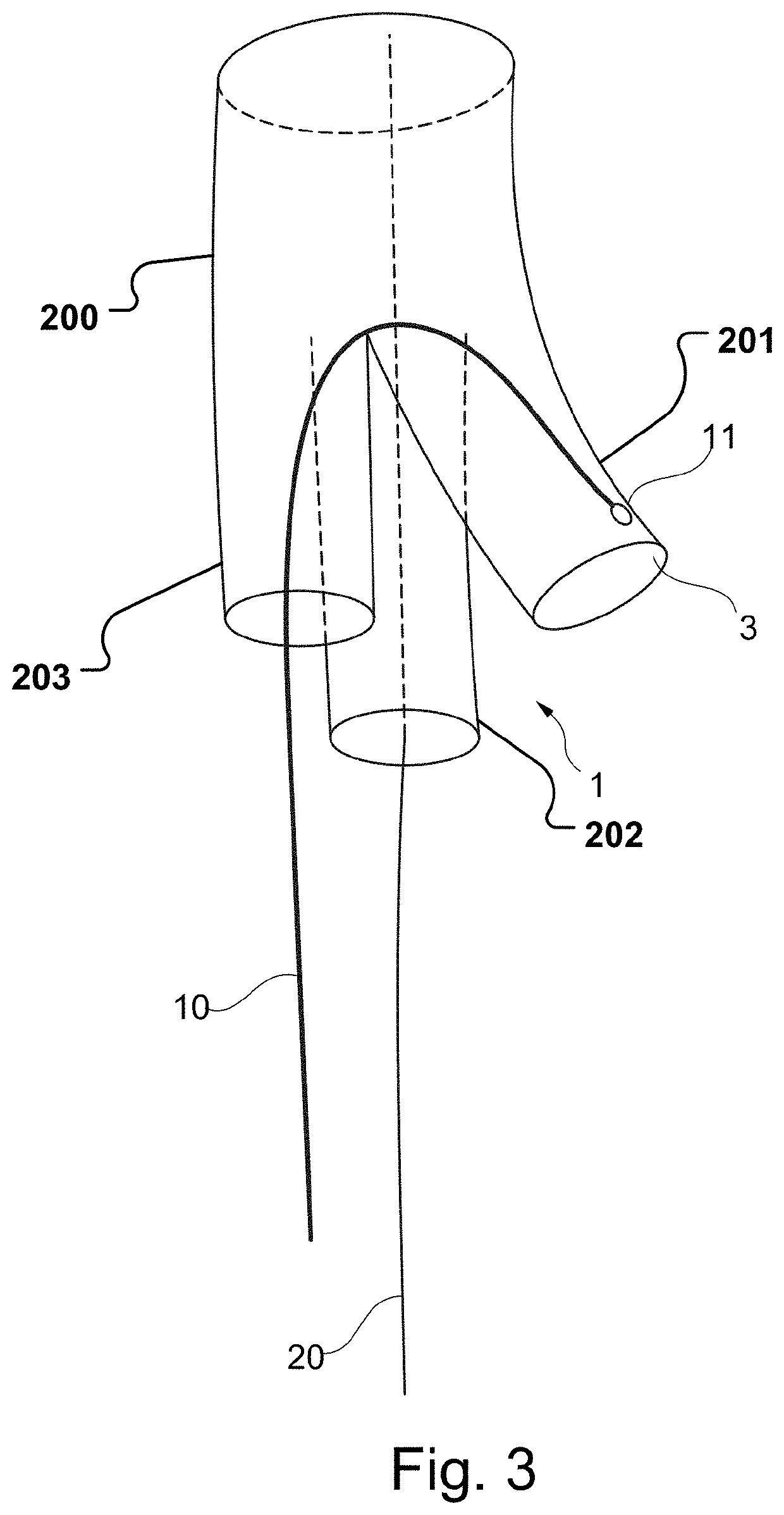 Vascular medical device, system and method