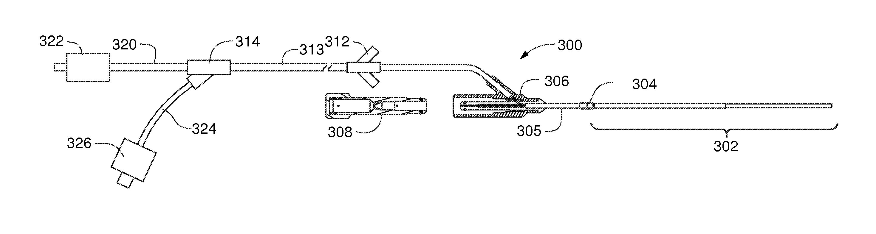 System and method for treating compartment syndrome