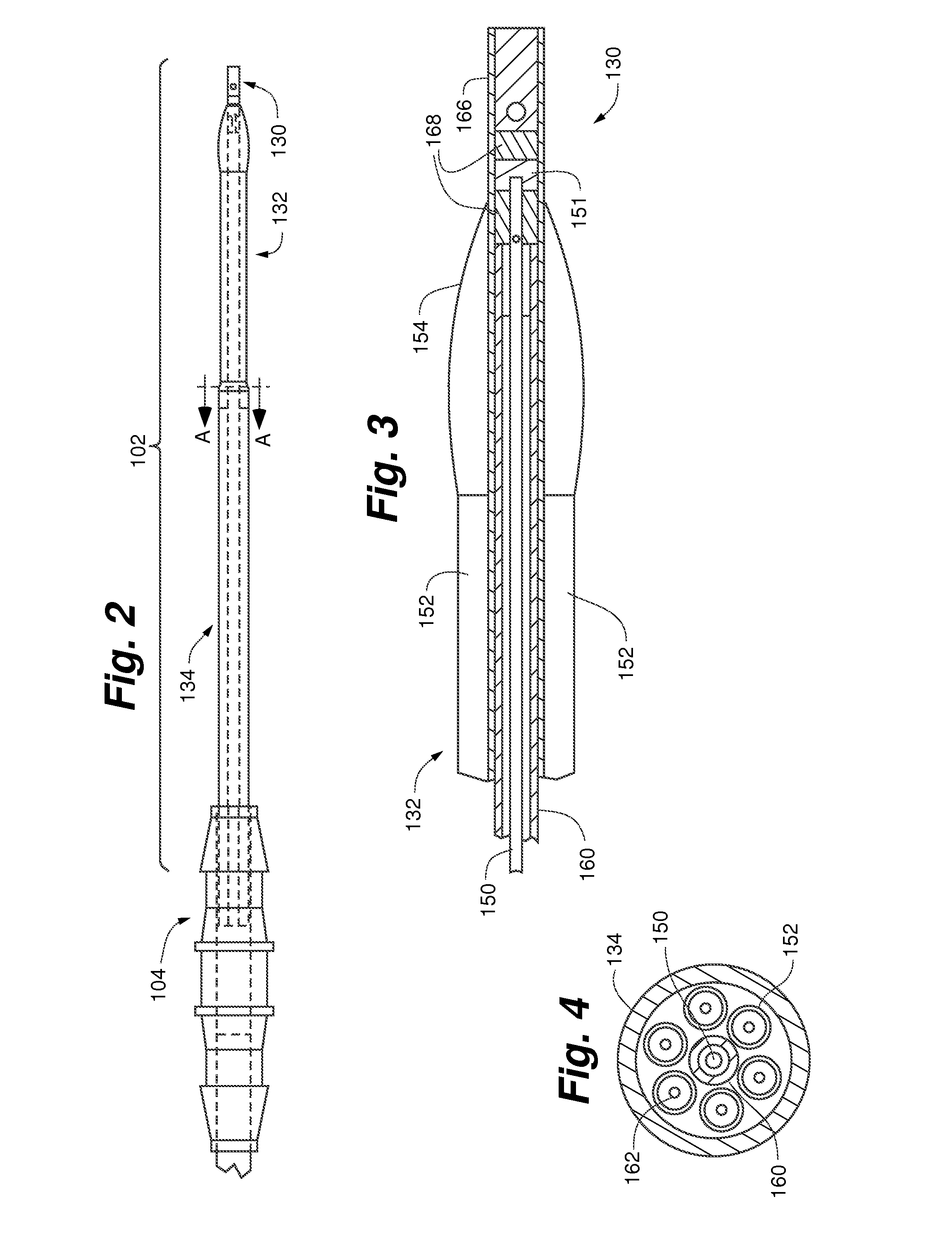 System and method for treating compartment syndrome