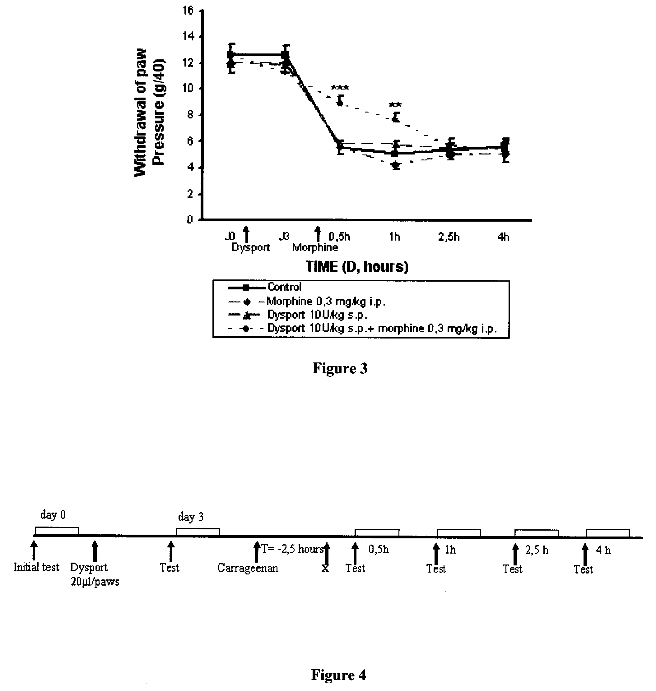 Simultaneous, separate or sequential therapeutic use of at least one botulinum neurotoxin and of at least one opiate derivative
