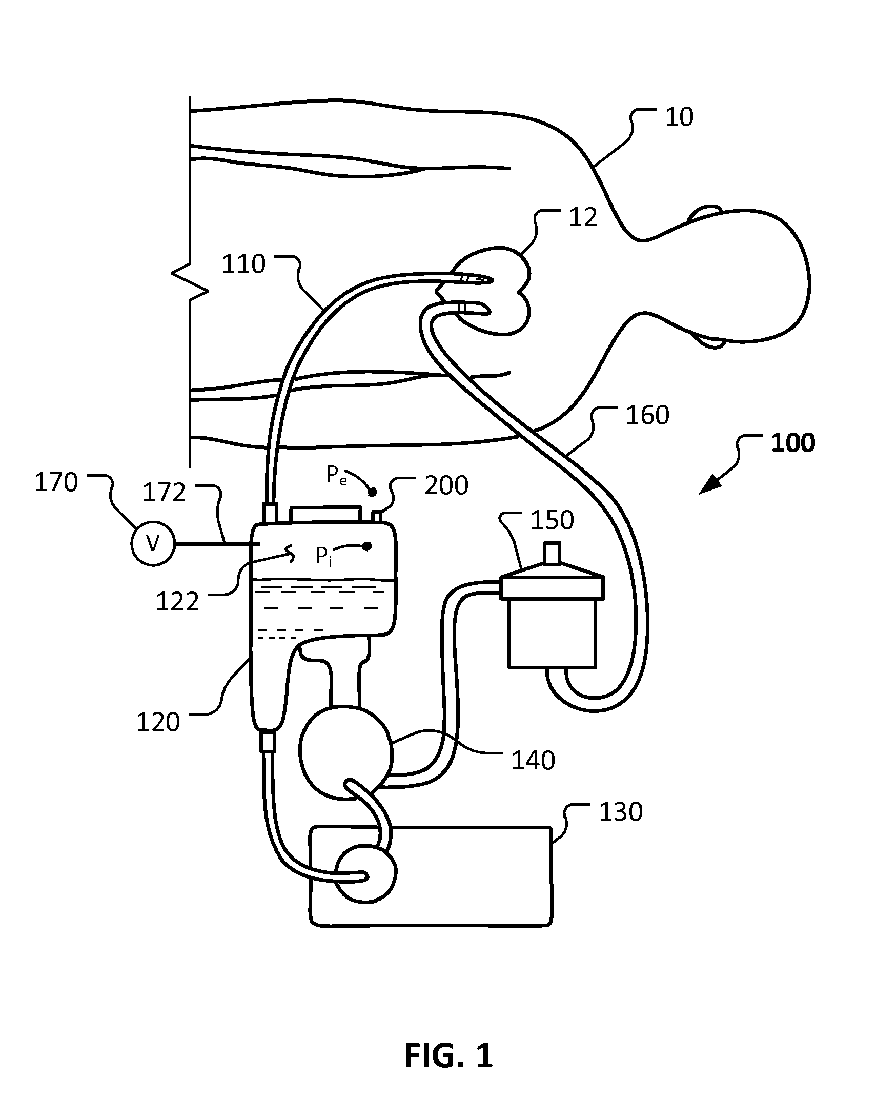 Pressure differential relief valve