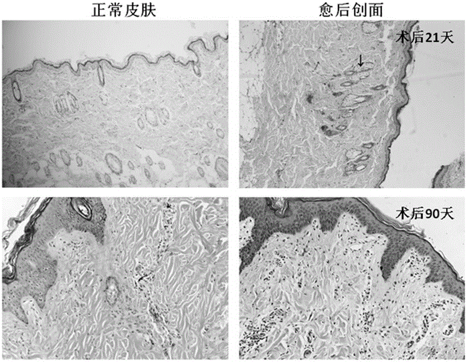 Polyurethane-based cellular material compounding vessel growth promotion factors and preparation method of polyurethane-based cellular material