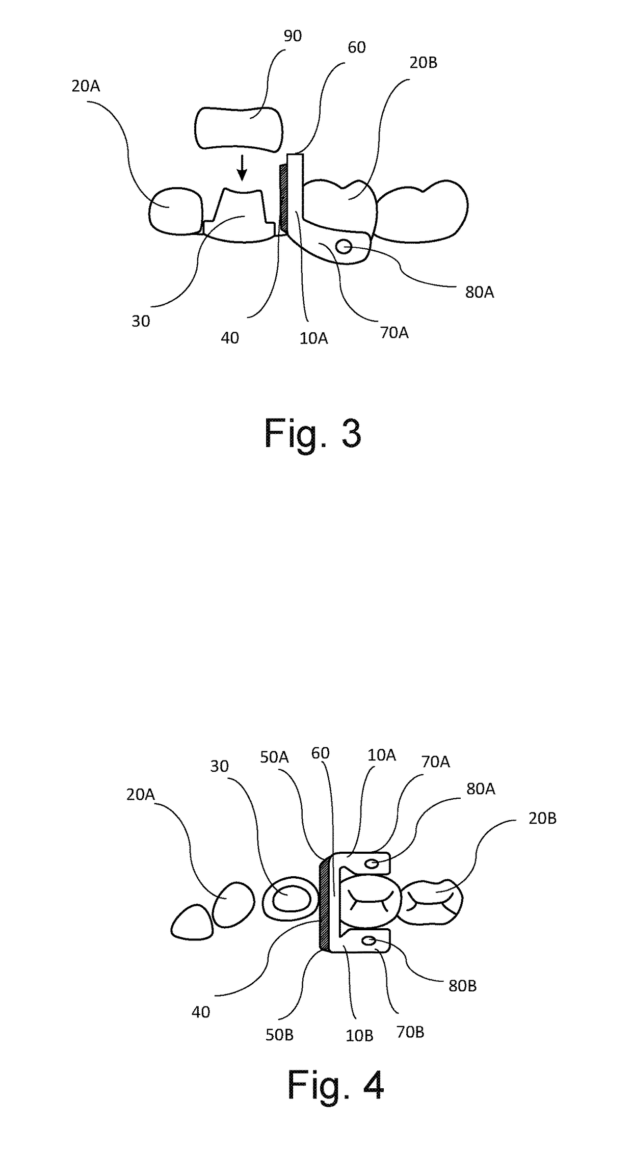 Device for Evaluating Dental Crown Contacts