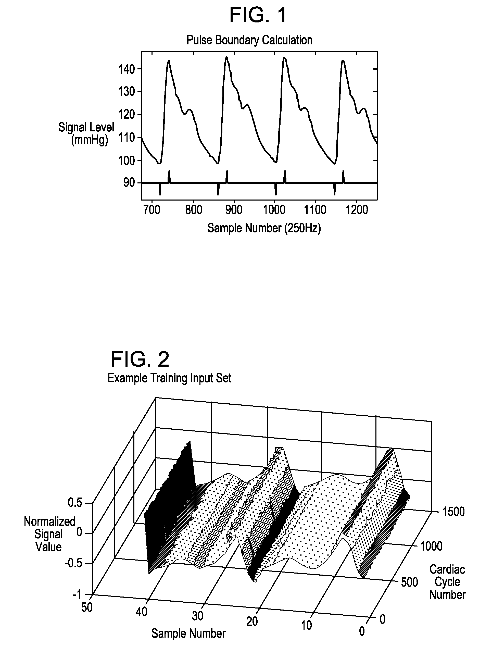 Systems and methods for determining intracranial pressure non-invasively and acoustic transducer assemblies for use in such systems